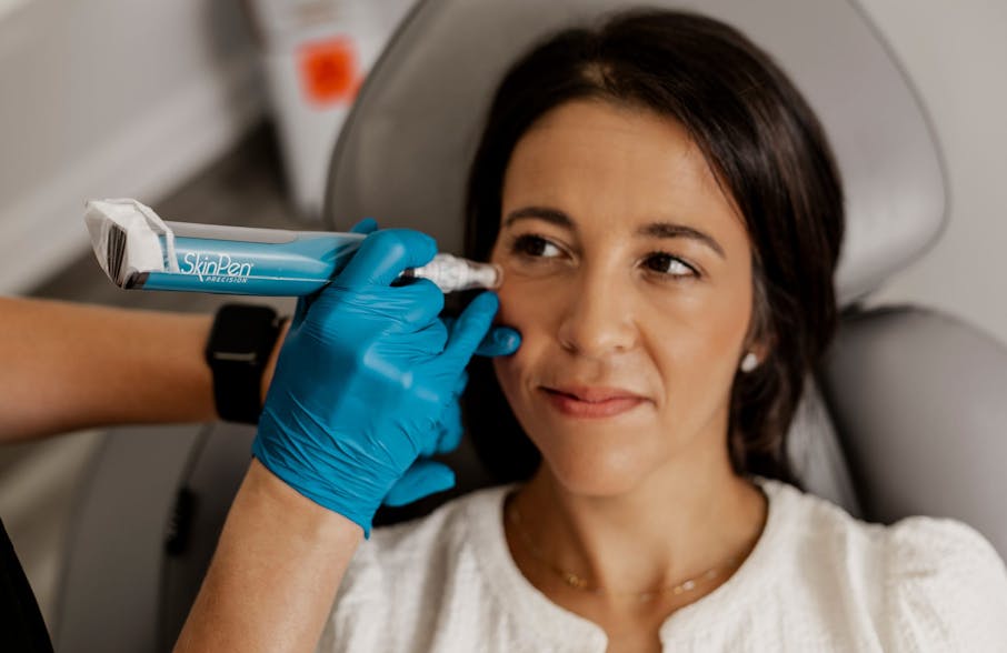 client laying in chair with skin pen against her cheekbone