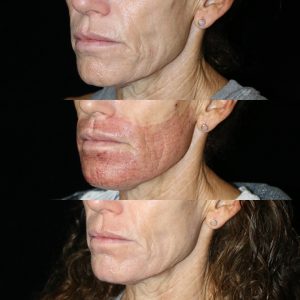 patient results