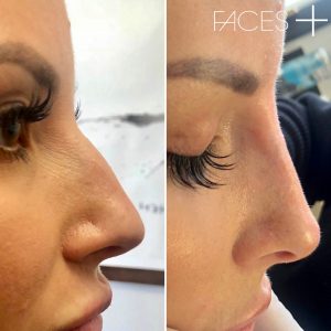 patient results