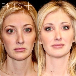 patient results