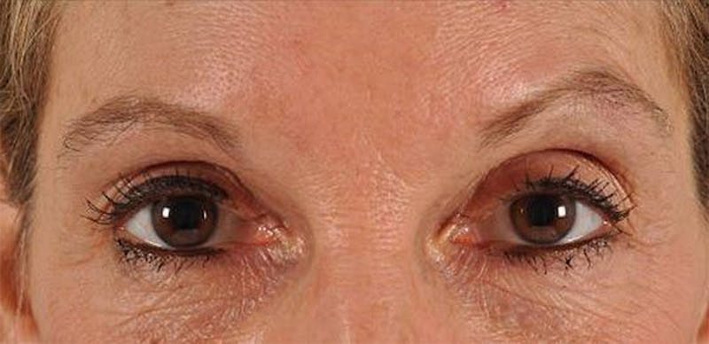 person's eyebrows