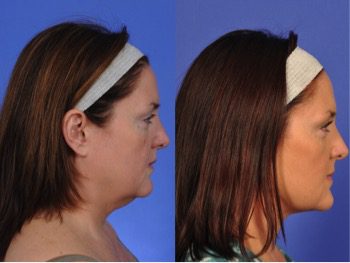 patient results