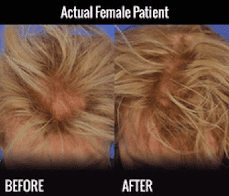 Customized hair loss solutions B&As