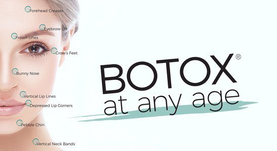 Botox at any age infographic