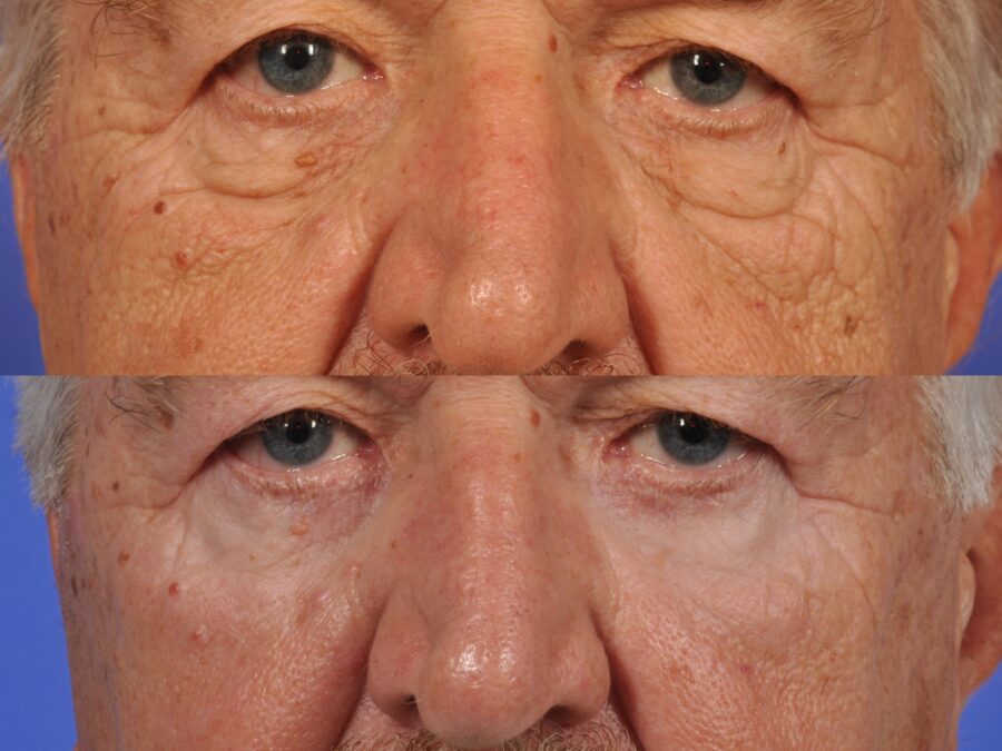 patient results
