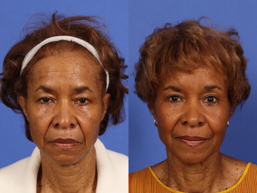 patient results