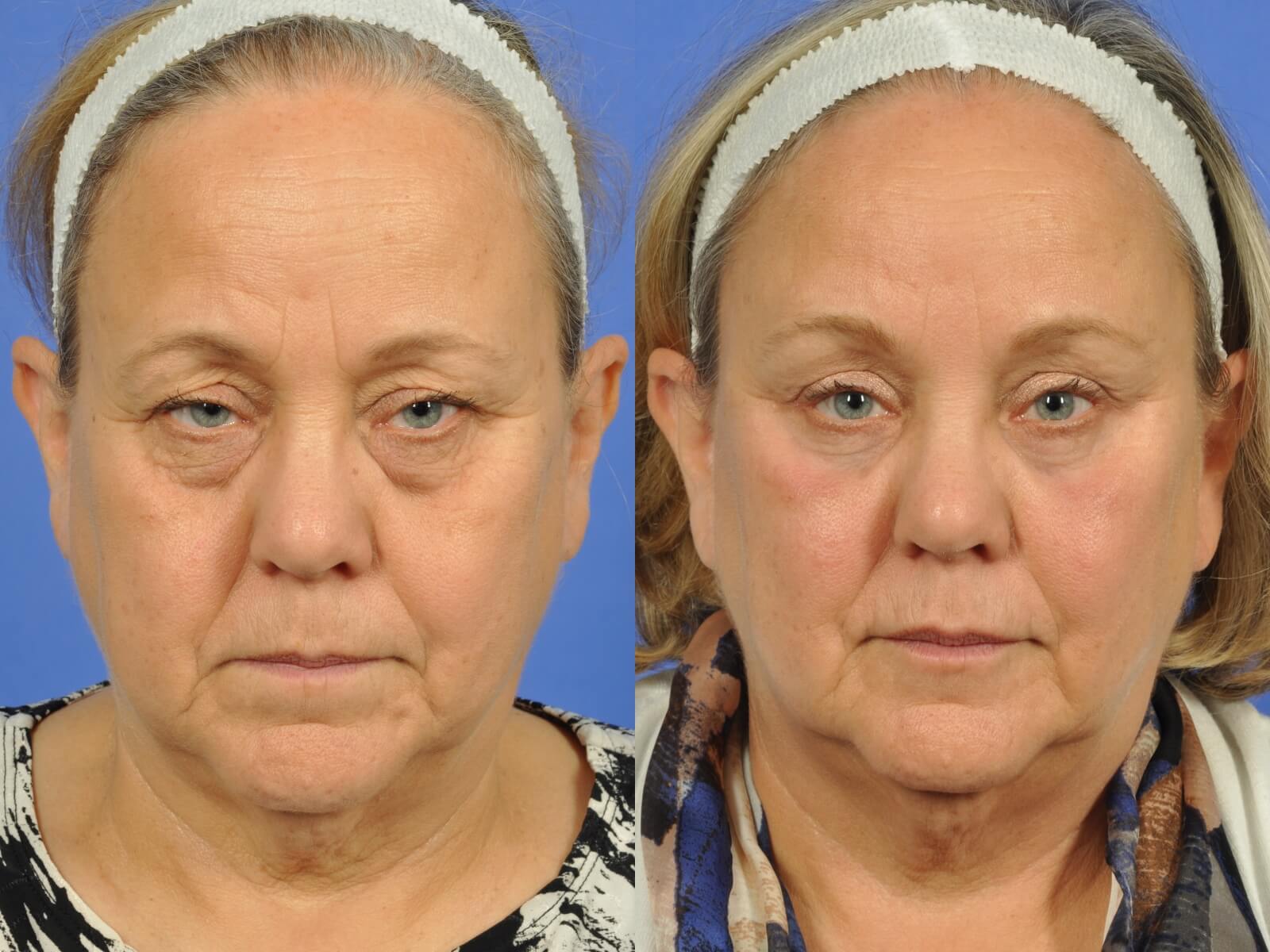 patient results