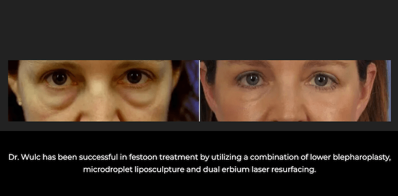 patient results