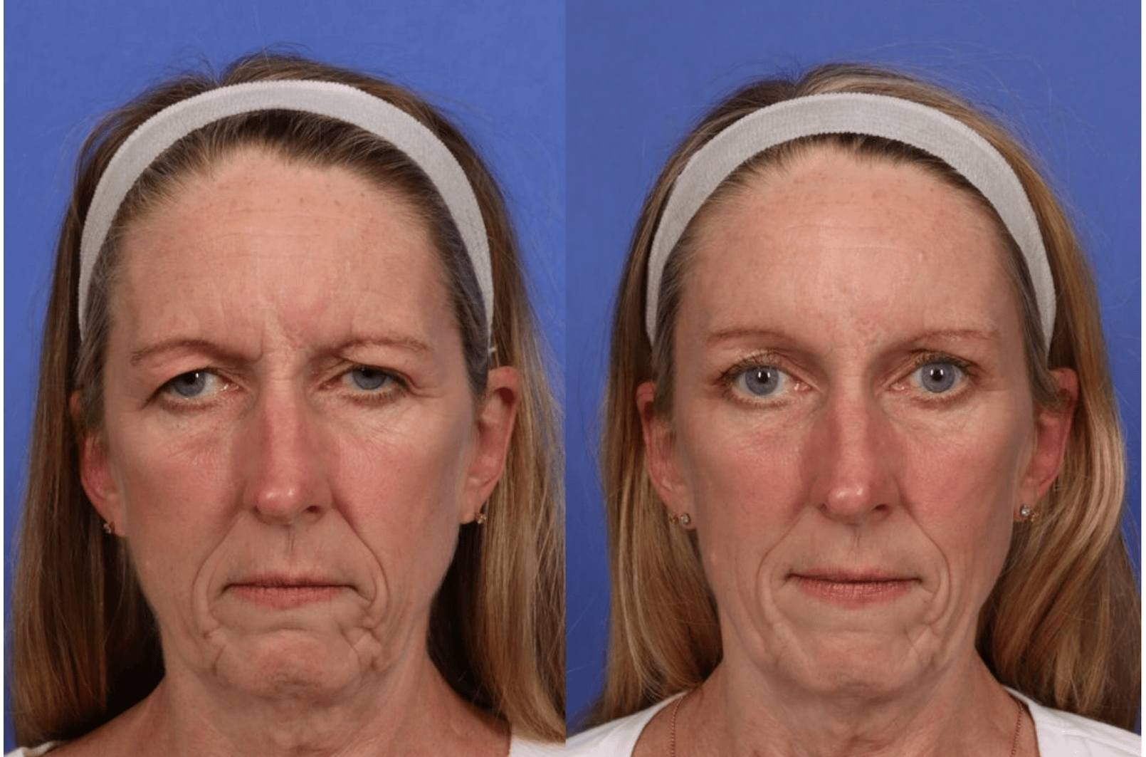 patient results