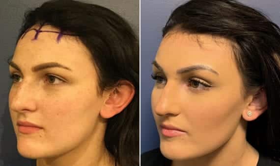 patient results