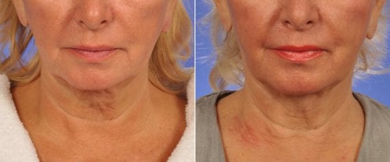 patient results