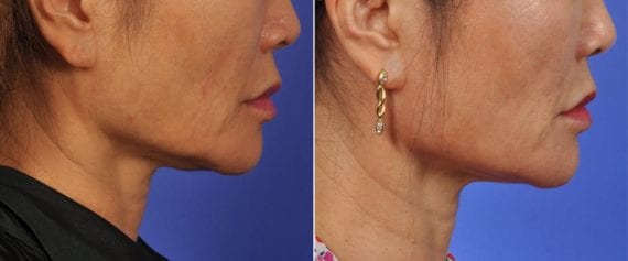 patient results