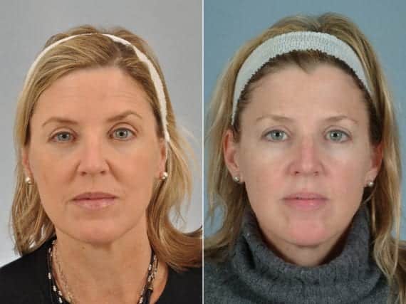 patient results