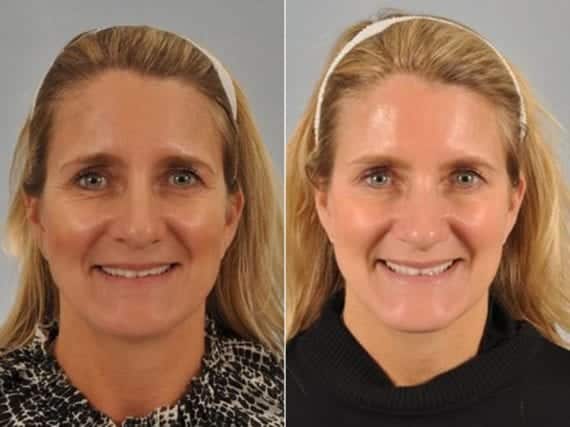 patient results