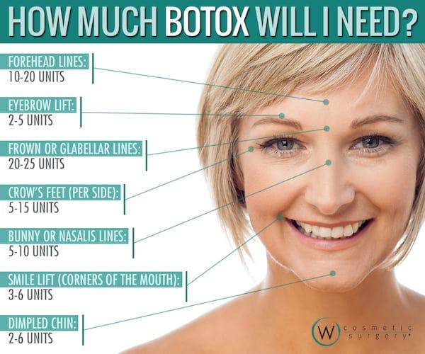 BOTOX infographic