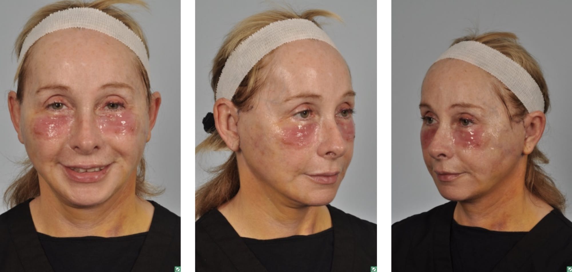 patient results
