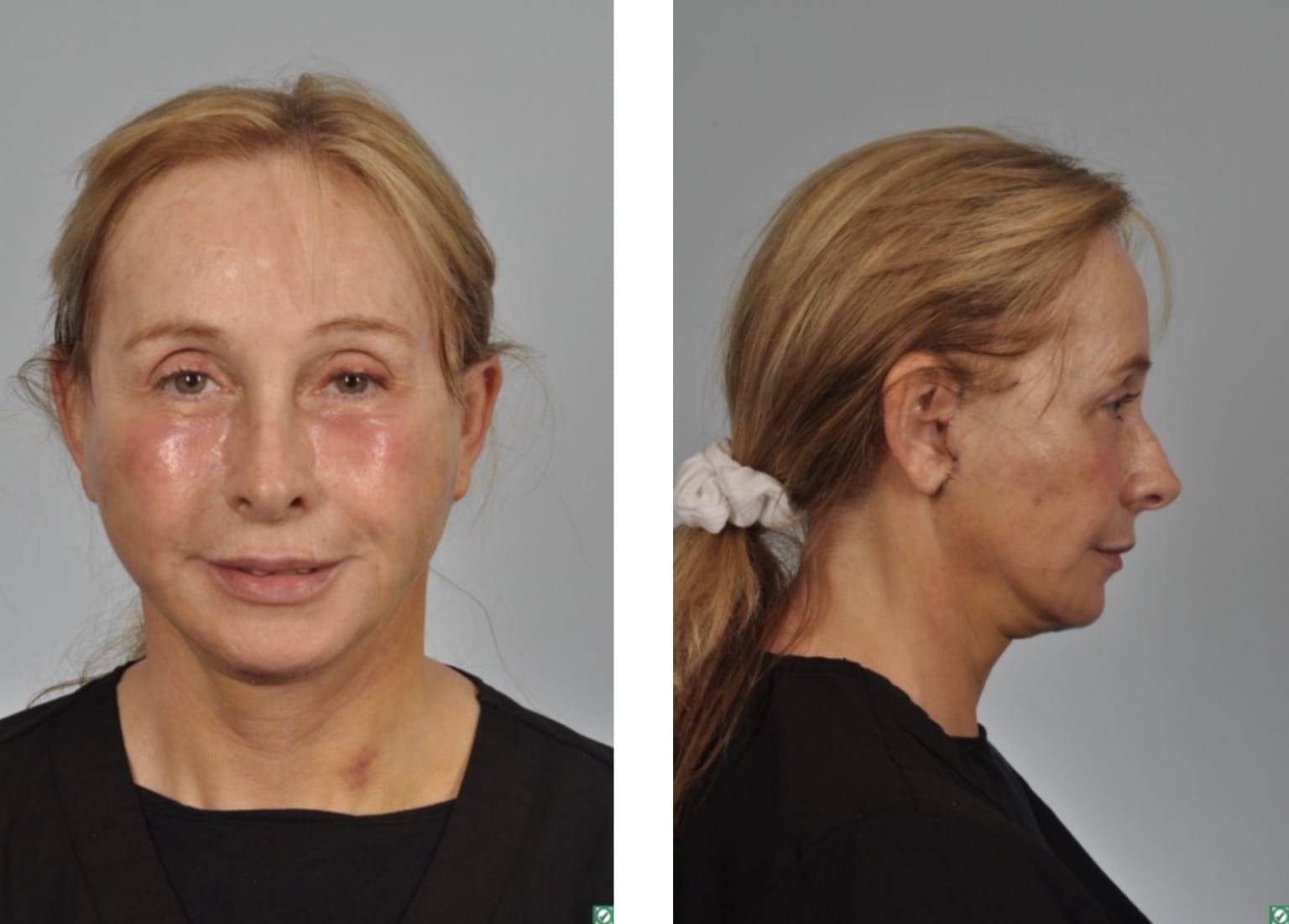 patient results