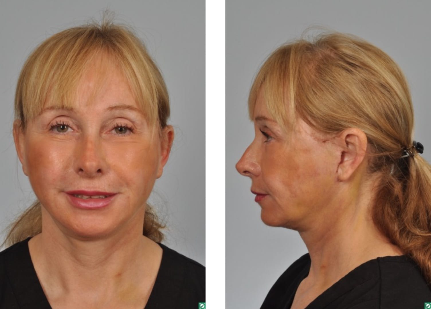 patient results