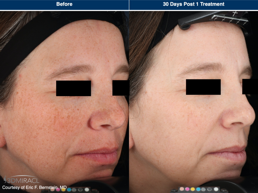 patient results