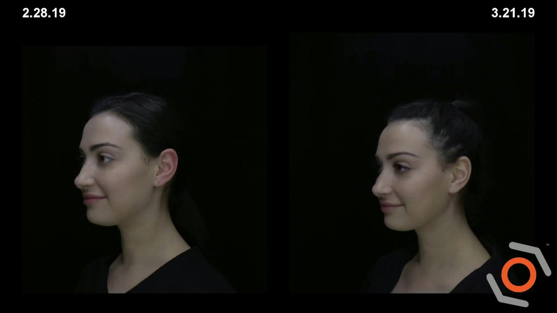 W Cosmetic Surgery