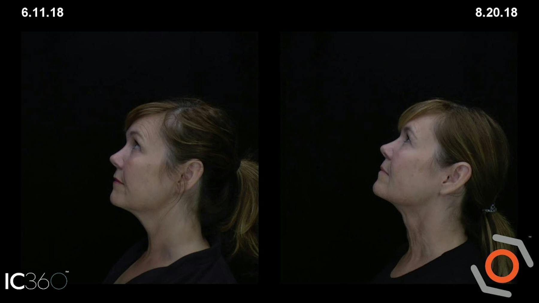 W Cosmetic Surgery