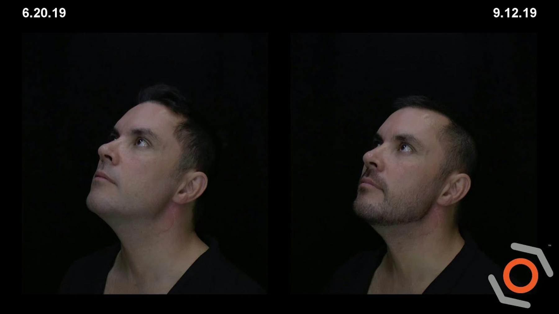 W Cosmetic Surgery