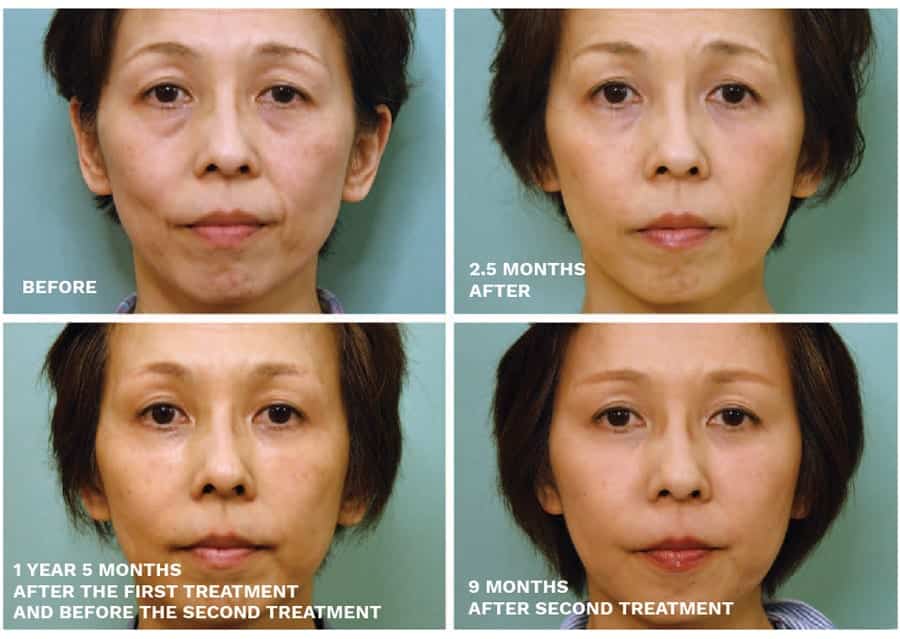 patient results