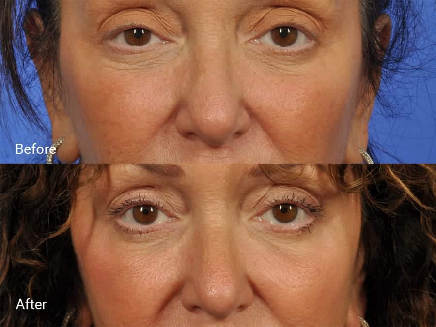 patient results