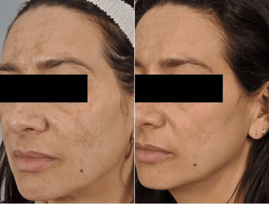 patient results
