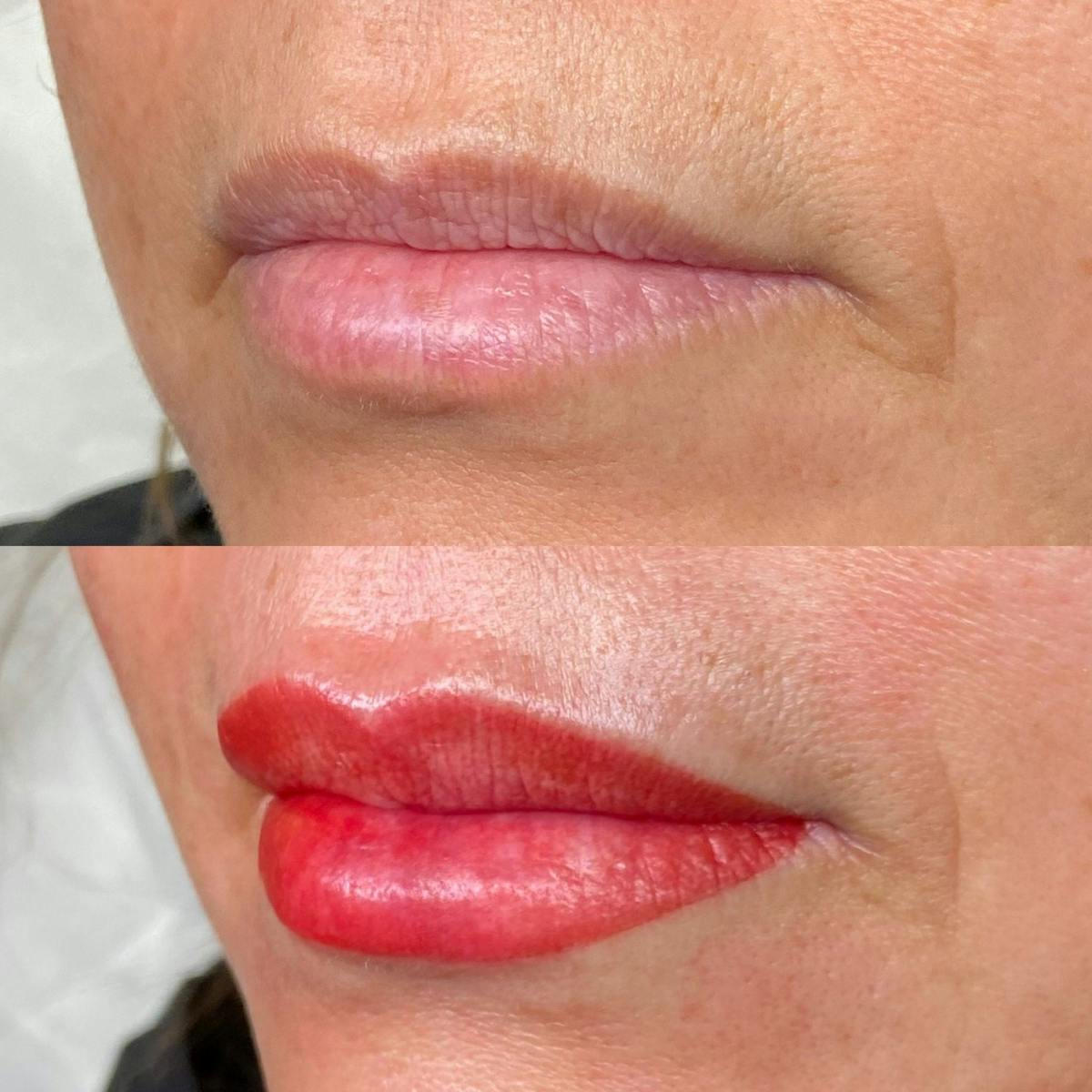 Permanent Makeup Before & After Gallery - Patient 336703 - Image 1