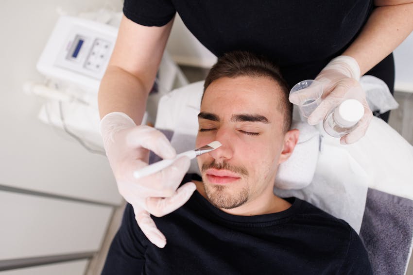 Man getting a chemical peel for acne