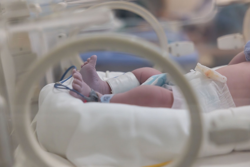 A baby in the NICU