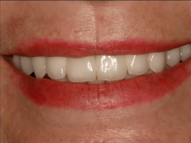 woman's smile close up