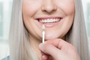 womans teeth