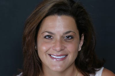 FloridasSmiles Porcelain Veneers Gallery patient