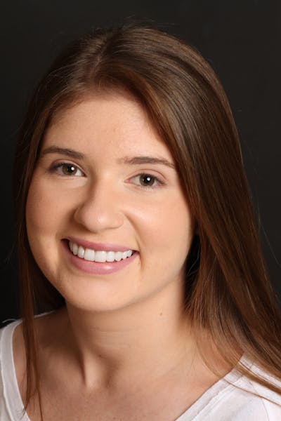 FloridasSmiles Porcelain Veneers Gallery patient