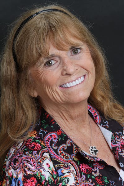 FloridasSmiles Porcelain Veneers Gallery patient