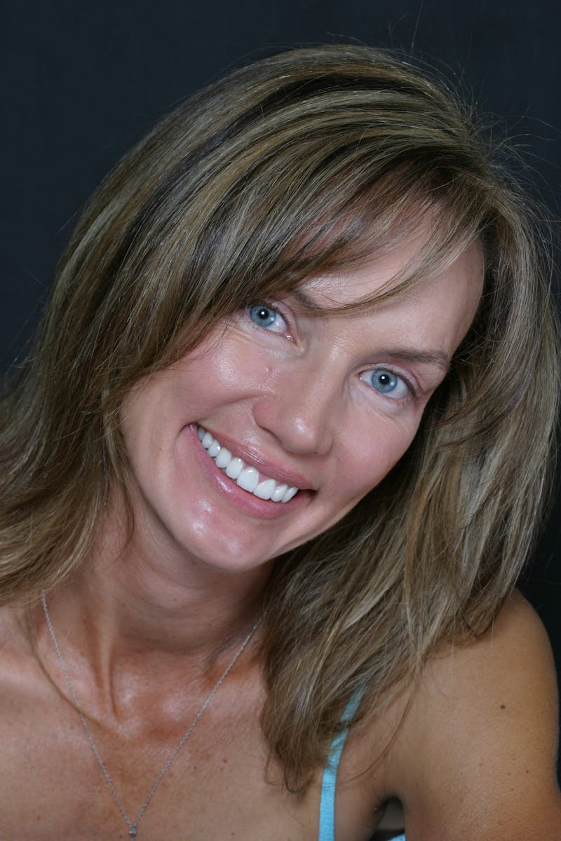 FloridasSmiles Smile Gallery patient