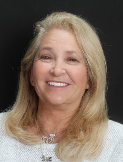 FloridasSmiles All-on-X Gallery patient