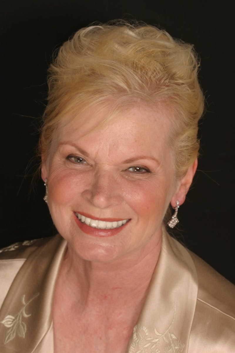 FloridasSmiles Smile Gallery patient