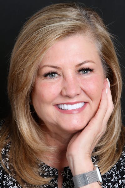 FloridasSmiles Porcelain Veneers Gallery patient