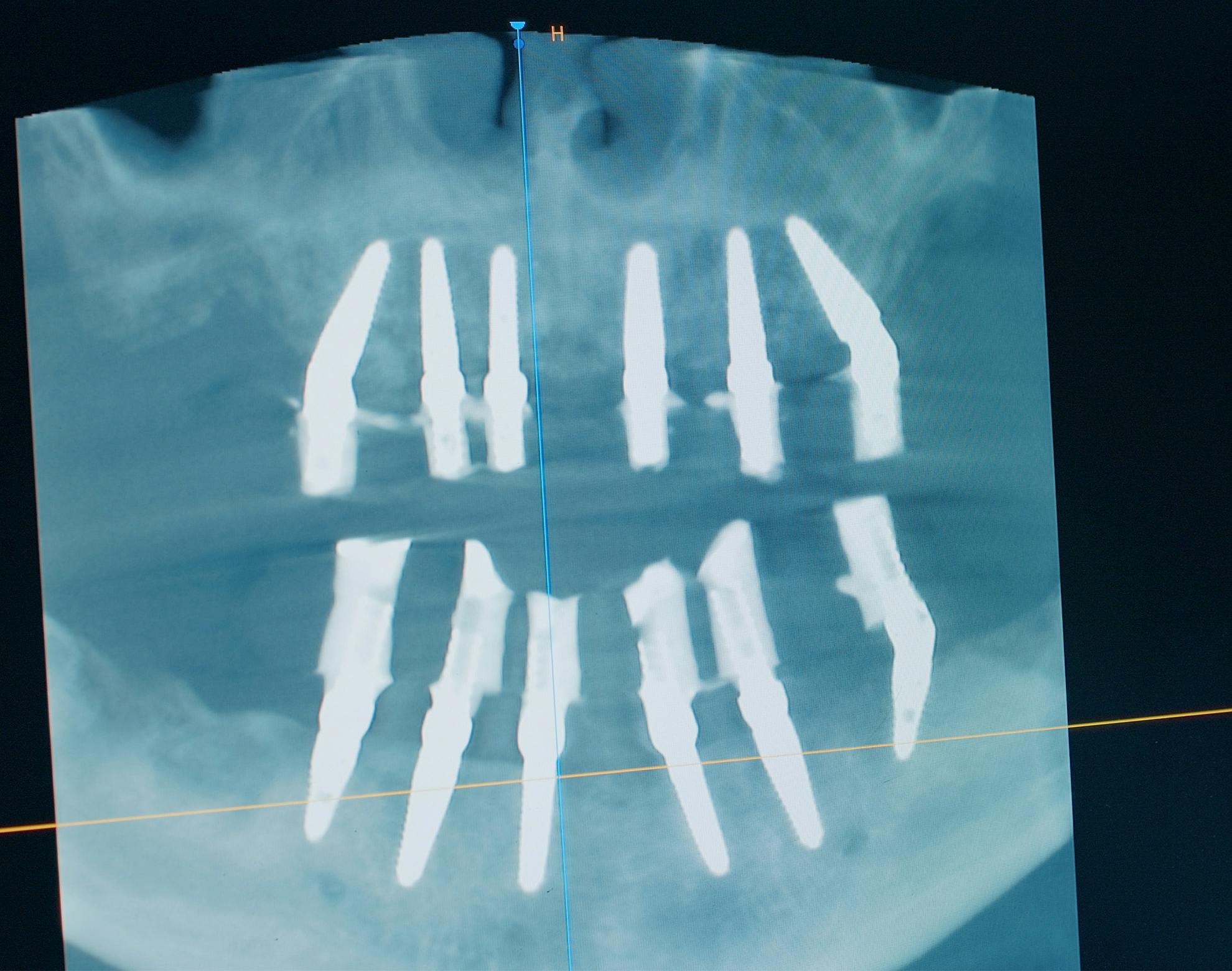 dental x ray