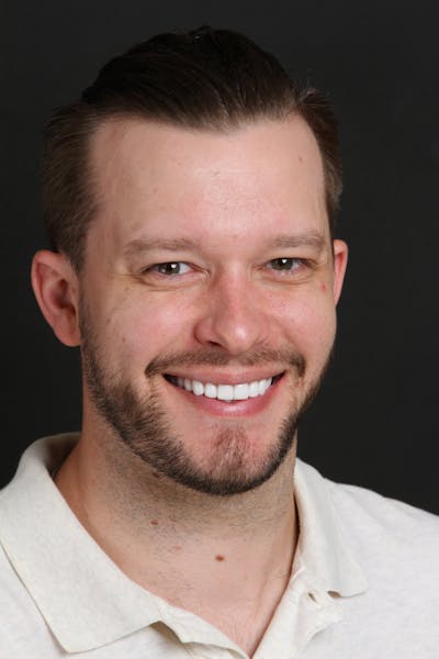 FloridasSmiles Gum Lifting Gallery patient