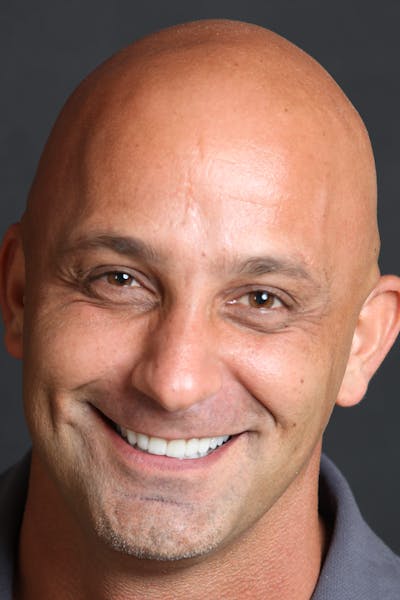 FloridasSmiles Porcelain Veneers Gallery patient