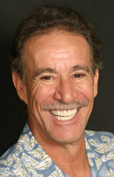 FloridasSmiles Porcelain Veneers Gallery patient