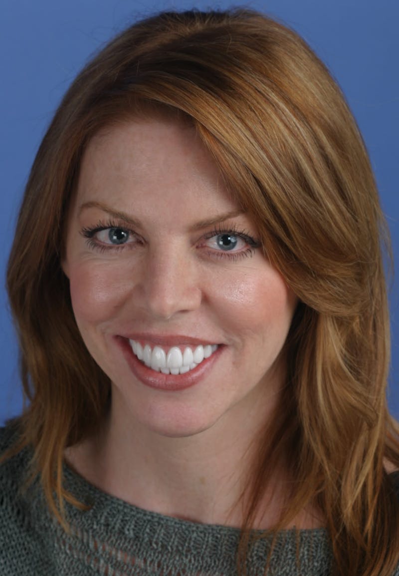 FloridasSmiles Smile Gallery patient