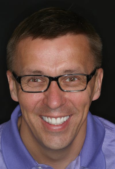 FloridasSmiles Smile Makeover Gallery patient