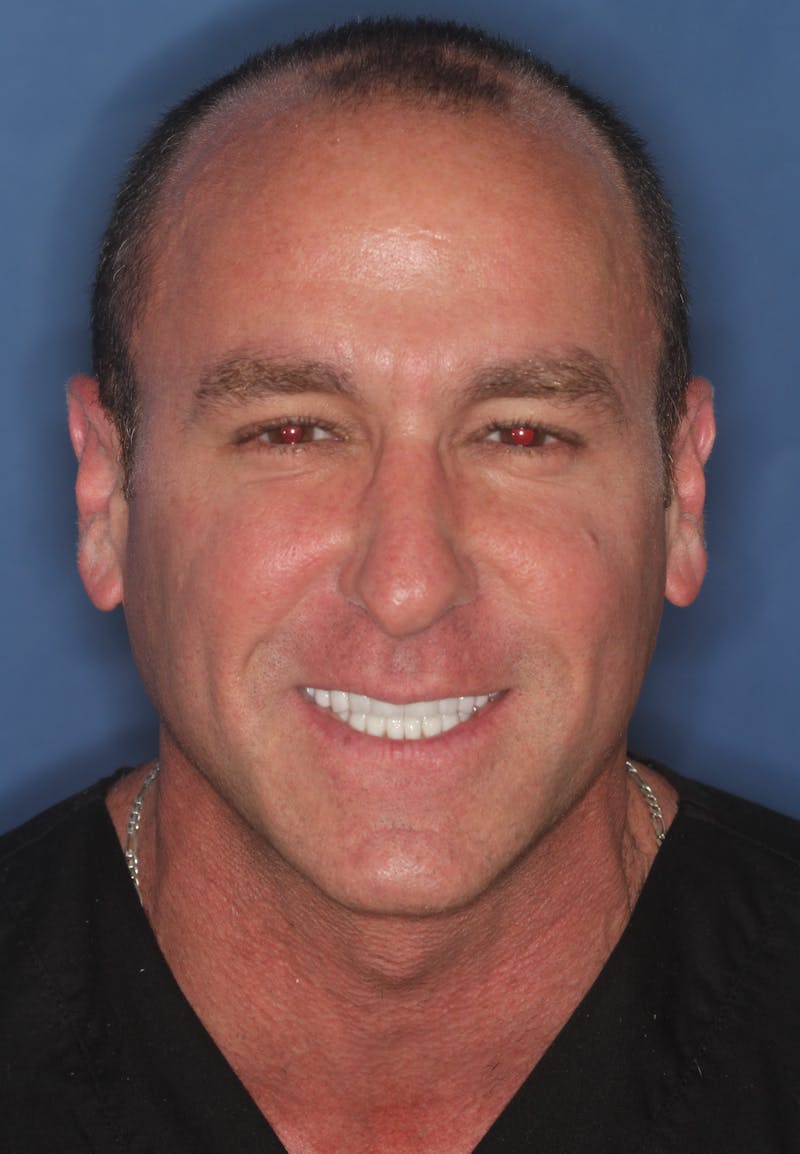 FloridasSmiles Smile Gallery patient