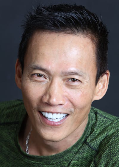 FloridasSmiles Porcelain Veneers Gallery patient