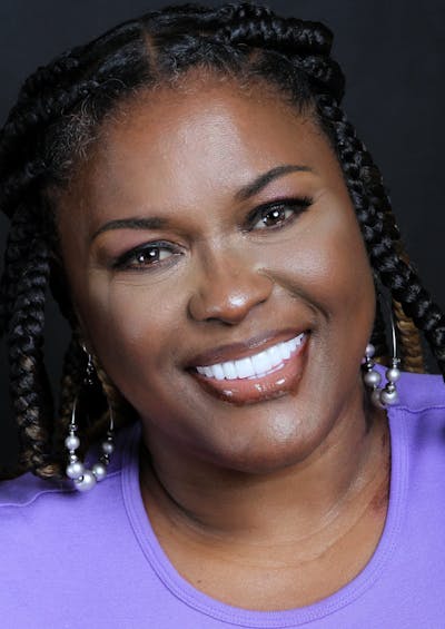 FloridasSmiles Porcelain Veneers Gallery patient